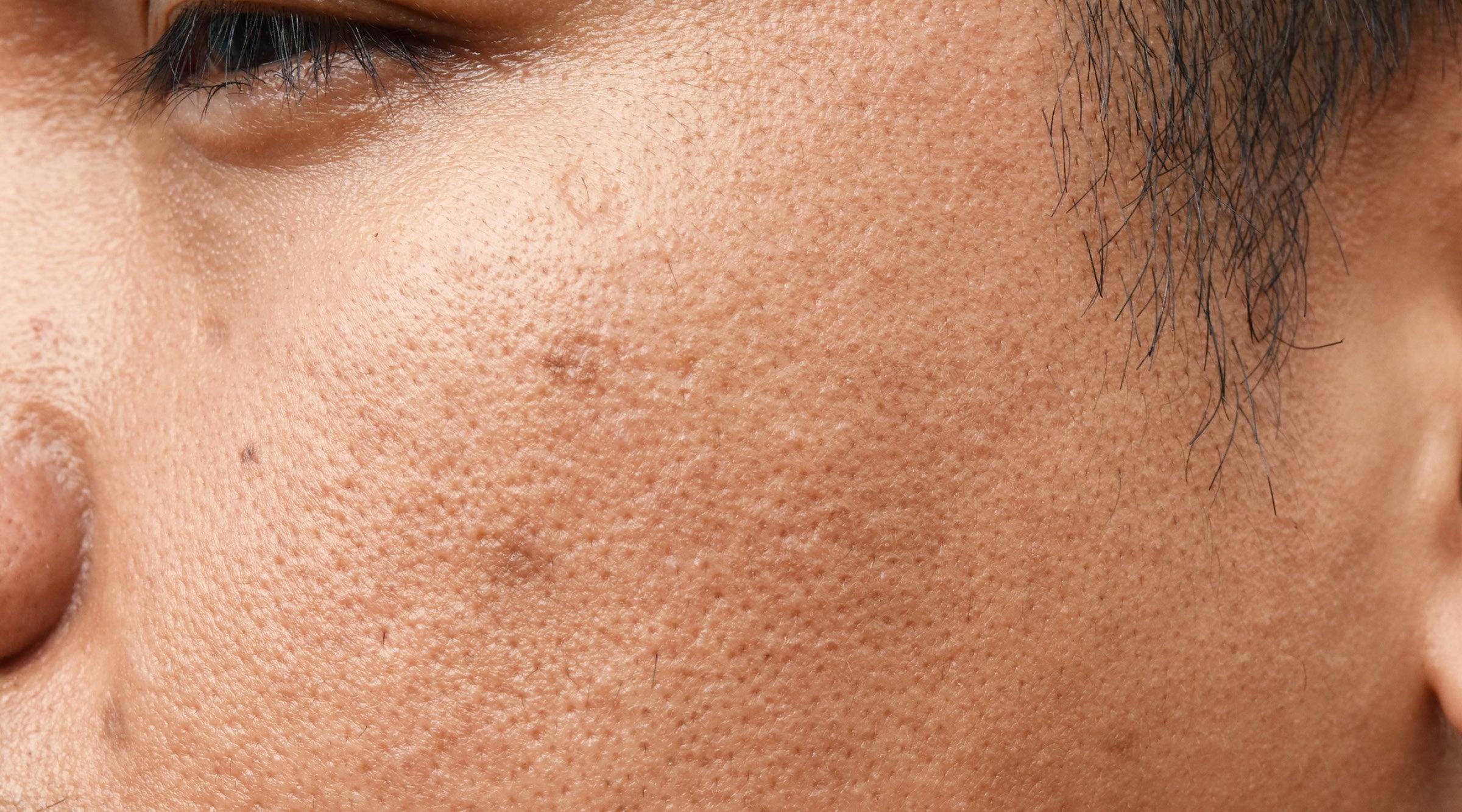How To Treat Oily and Combination Skin Types